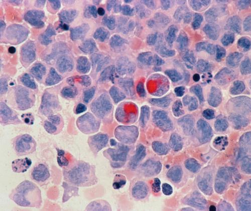 Registre général des cancers de Corse - Incidences 2017-2019
