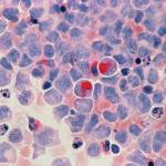 Registre général des cancers de Corse - Incidences 2017-2019